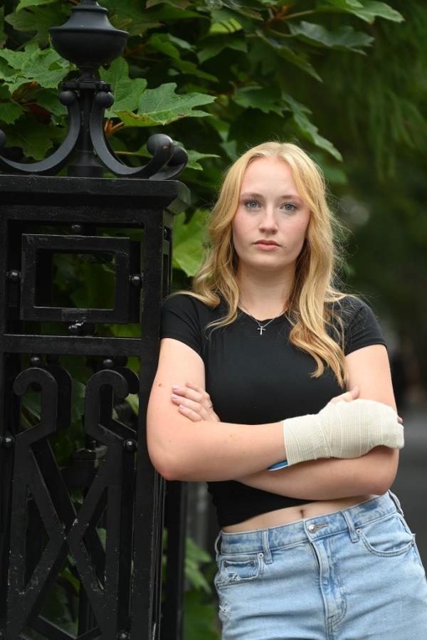 Alexa Very poses with a splint on her right hand in Washington Square Park this week 